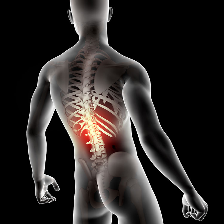 Lower Back Pain Treatment physiotherapy treatment