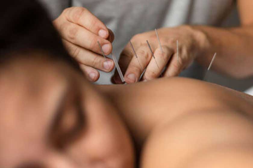 Knee Pain Physiotherapy Acupuncture