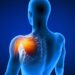 Lower Back Pain Treatment physiotherapy treatment
