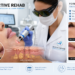 Laser Therapy for Fordyce Spots: Cost, Results & Recovery Guide 2026